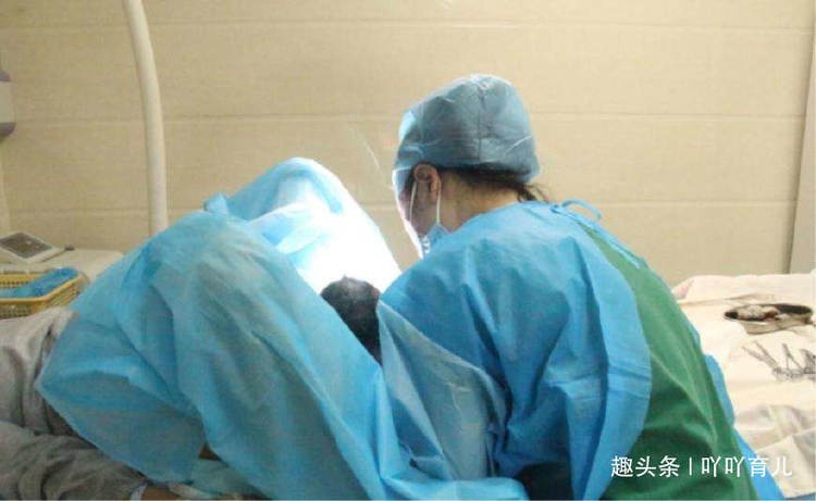 顺产那么好，95后孕妇却更喜欢剖腹产，并非怕疼，3点原因很现实