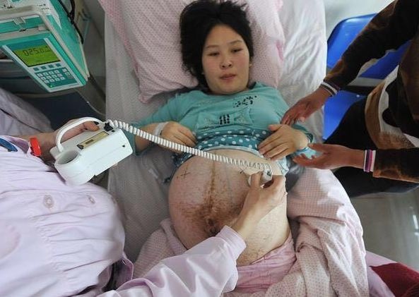 女性是否“生育”过能被医生看出吗？医生：有3个方面很难隐瞒