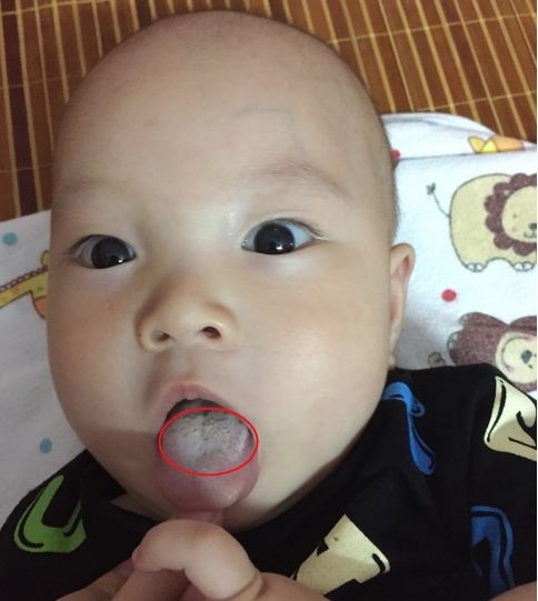 如果宝宝发出7种表现，说明是身体“积食”了，家长别忽视
