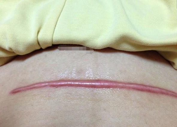 女性是否“生育”过能被医生看出吗？医生：有3个方面很难隐瞒