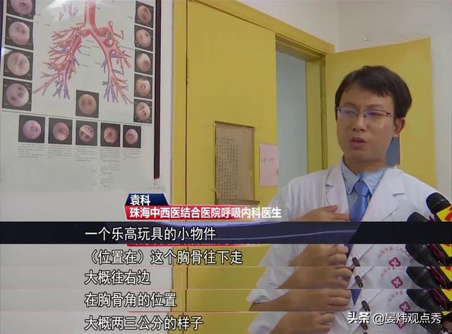 什么操作？女儿吞异物 妈妈救娃心切吸入自己气管