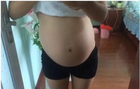 孕期时，孕妈若出现4种征兆，多半是“羊水”变少，要懂得