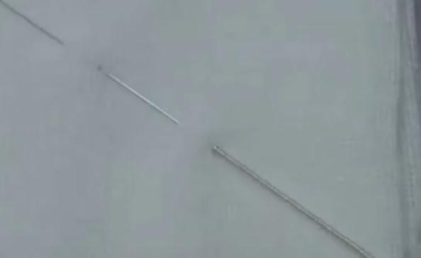 男孩写作业犯困，将长针插入尿道保持清醒，结果悲剧了