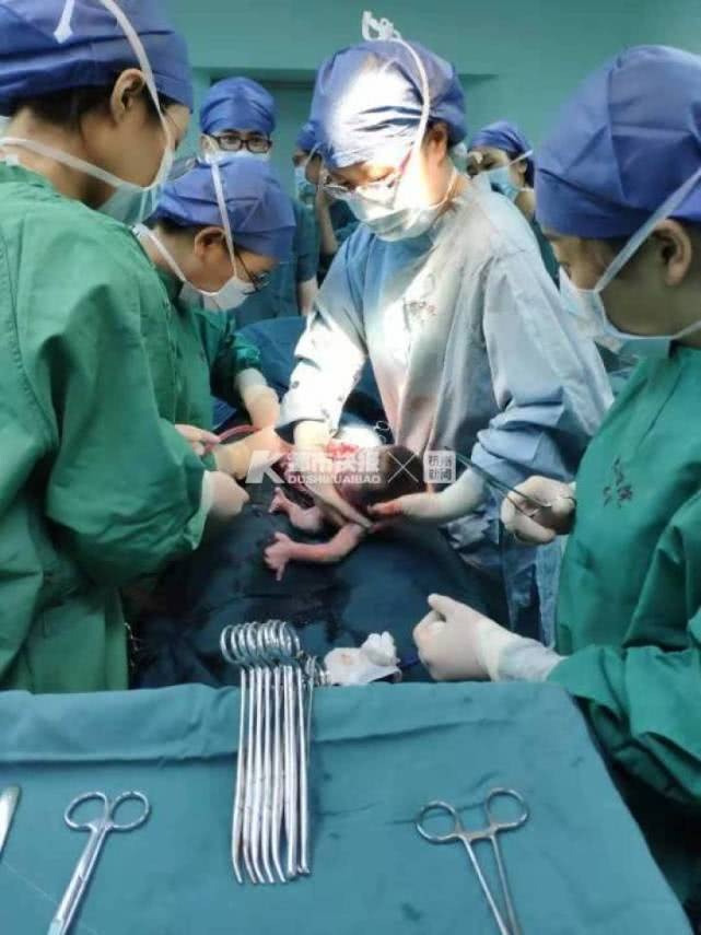 身高128cm，佝偻病、软骨症、脊柱侧突的她，顺利生子！