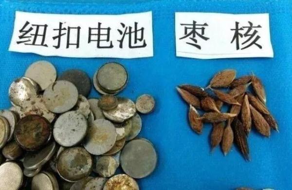 胃部腐蚀……这都是被孩子吞下过的，太可怕了