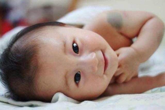 为什么宝宝天生就有“胎记”？妈妈再不注意这几个问题，就晚了