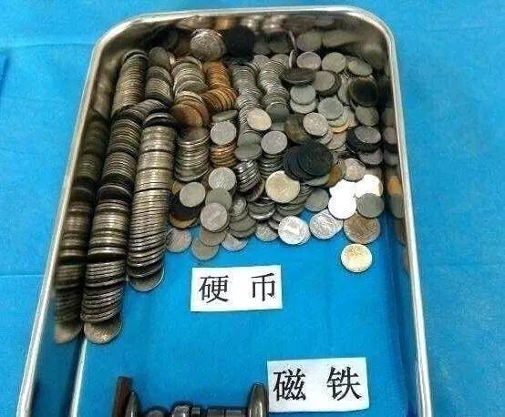 胃部腐蚀……这都是被孩子吞下过的，太可怕了