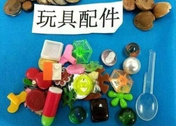 胃部腐蚀……这都是被孩子吞下过的，太可怕了