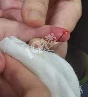 商场厕所里的这个“暗器”，让3岁男孩全麻后手指缝了7针...