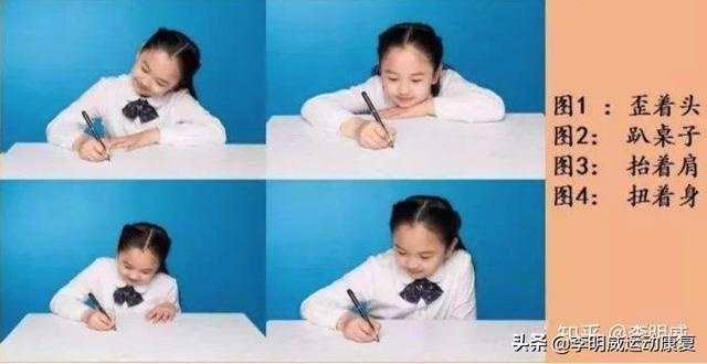 脊柱侧弯的认识与早期检查（孩子家长与老师必看）