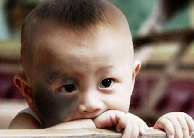 为什么宝宝天生就有“胎记”？妈妈再不注意这几个问题，就晚了