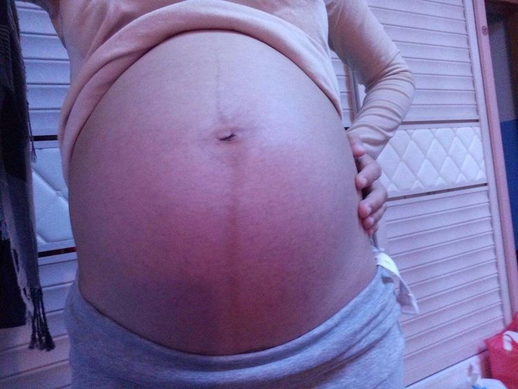 怀孕后，妈妈肚子上那条黑线，隐藏了4个小秘密，和宝宝没有关系