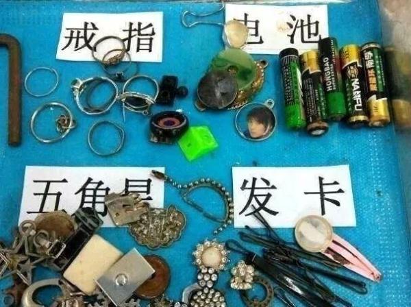 胃部腐蚀……这都是被孩子吞下过的，太可怕了