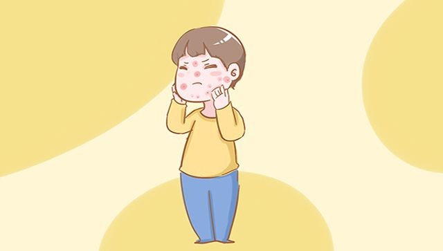 宝宝夏季皮肤皴裂？医生：家长做不好这些工作，啥时间娃都躲不过