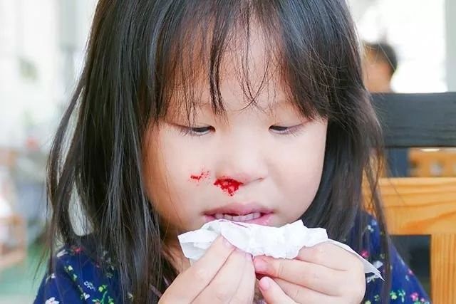 2岁宝宝流鼻血，紧急送医后却抢救无效，求求家长们别再犯错了