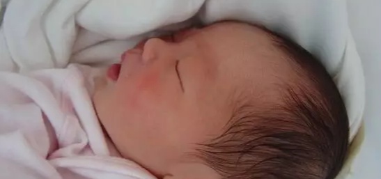 当新生儿出现这几种“异常情况”，请不要慌