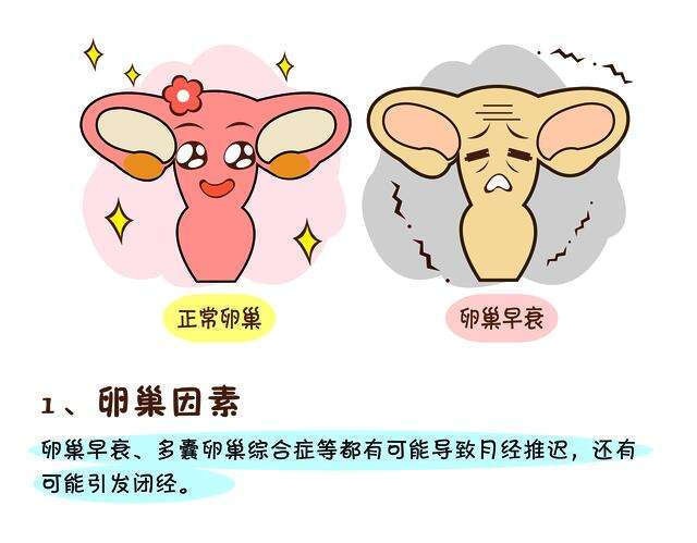 6个月没有月经，又没有怀孕怎么回事？关于月经备孕妈妈了解多少