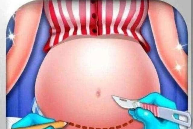 生完孩子的女性易发胖，是什么原因，如何尽快改正？令人不可思议