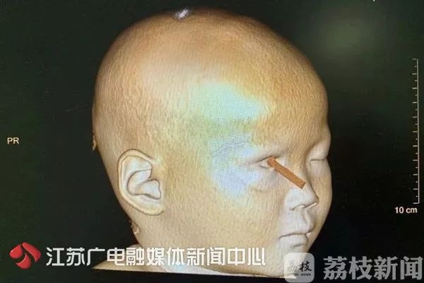 暑期意外伤害高发 小心儿童健康“第一杀手”！这些施救妙招请收好