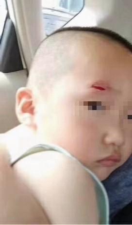 我是3岁男孩的妈妈，幼儿园老师的电话里，听到孩子痛苦的哭声…