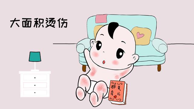 孩子被开水烫伤，宝爸第一时间这样做，医生知道后连连称赞