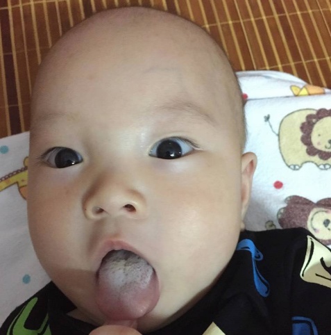孩子的脸部出现这些“现象”，可能暗示脾胃有问题了，家长要留意
