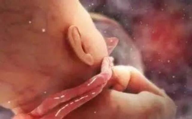 产妇孕期的习惯导致胎儿“花式绕颈”，只能剖腹，你有这个习惯吗