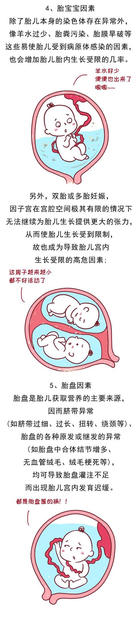 孕妈日常的一个行为竟造成胎儿宫内发育迟缓，早发现早改正