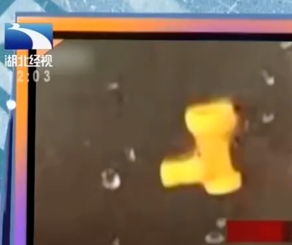 顽皮女儿误吞积木，母亲嘴对嘴吸出，不料把自己送进了医院