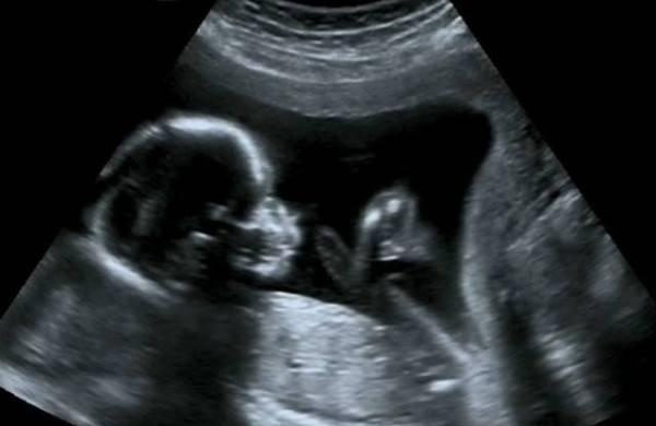 孕妈收藏：怀孕多久有胎动、胎动是什么感觉、怎么做能感觉到胎动