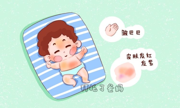 新生宝宝都病了你却不知道？判断新生儿是否健康，看4点就明白