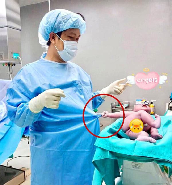 刚剪完脐带的宝宝，拉着医生手术服不撒手，网友：瞧这暴脾气