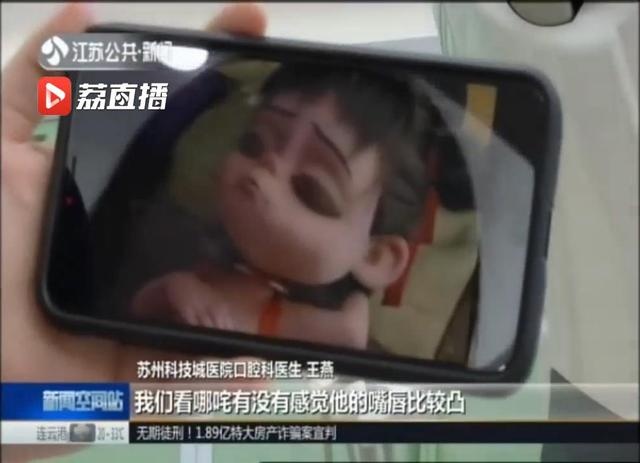 “我牙由我不由天？”苏州一医生巧用“丑哪吒”做“牙齿”科普