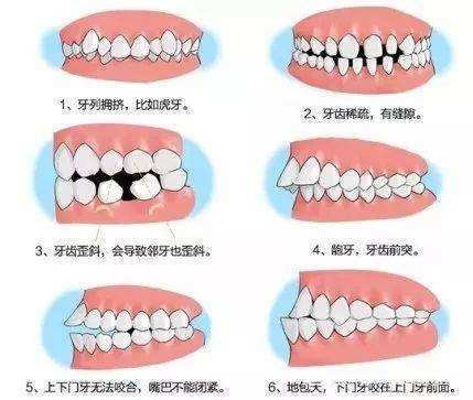 做牙齿矫正的最佳年龄是在多少岁？成年后，还适合矫正牙齿吗？