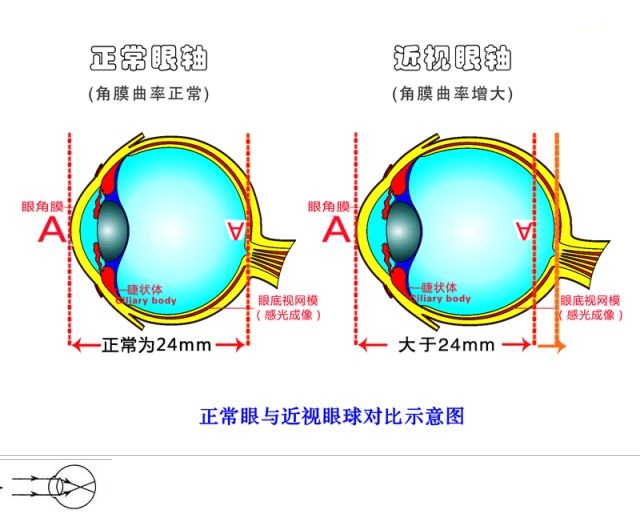 廊坊疾控郑重提示：视力损伤不可逆，别给孩子成长留遗憾！