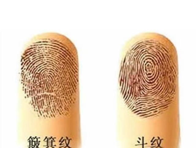 一斗穷，二斗富，手上斗越多越聪明，看看你家宝宝手上占几个？