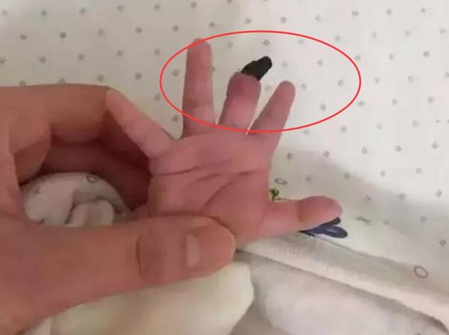 宝妈担心宝宝抓伤自己，买了手套后酿成惨剧，这个东西你在用吗？