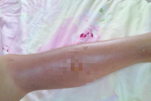 宝宝被保温杯烫伤，妈妈难辞其咎，保温杯的选择这三点很重要