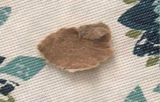 女婴上颚突现巨大黑斑，宝妈急忙带去就诊，结果让大家笑趴