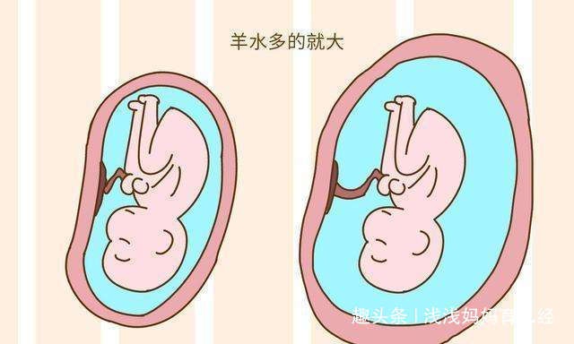 孕期：通过孕肚可判断胎儿是否健康？6个因素决定孕妈妈孕肚大小