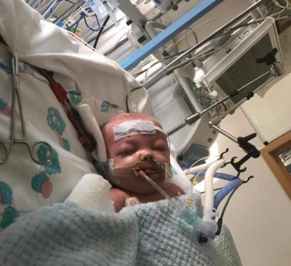 嗓子感染引发败血症四肢全截 11月大男婴惊魂记