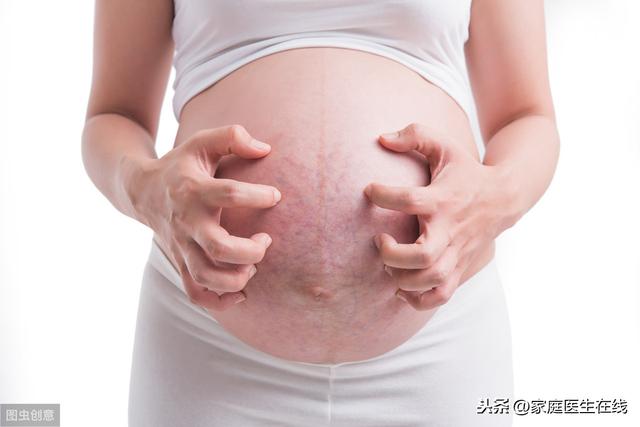 妊娠纹能否完全去掉？妈妈们可以尝试一下这几个办法