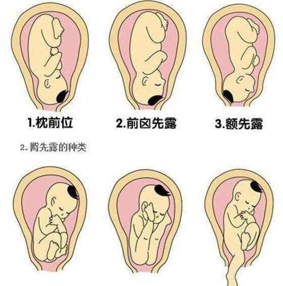 肚型不一样，胎儿性别不一样，是真的吗？