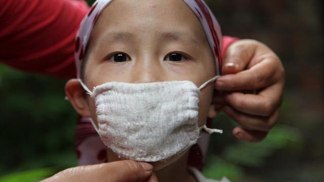 1岁女婴患白血病，医生给宝妈忠告：这样的玩具不要给孩子买