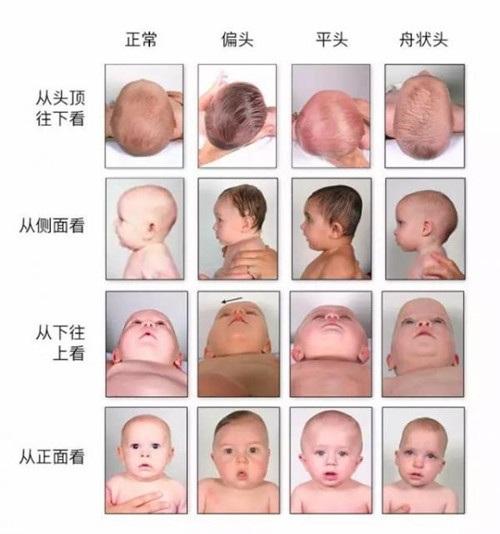 宝宝出生后，如何睡出漂亮头型？