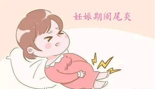 孕期患上阑尾炎怎么办？对胎儿会有影响吗？专业医生告诉你！