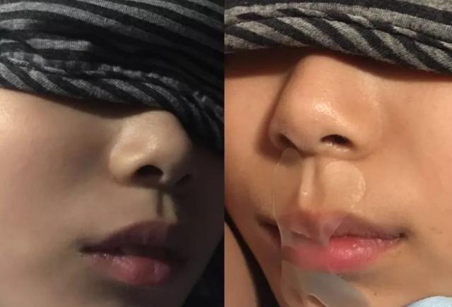 9岁女孩每晚睡觉，被妈妈用胶布封嘴，医生却对妈妈说做得好
