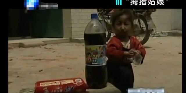 女子怀孕肚子没反应，孩子出生不到二斤，五岁跟可乐瓶一样高