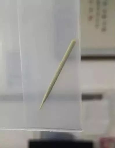 女童肠子戳穿两个洞,竟然是因为误吞了它!