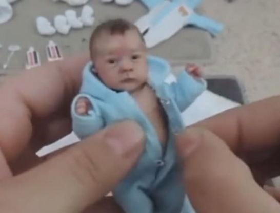 男子给拇指婴儿穿衣服，父母抱宝宝纷纷驻足，看清后感觉不可思议